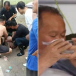 Kadini kurtarmak isterken dehseti yasadi saldirgan burnunu koparip yuttu pEPM1qFf
